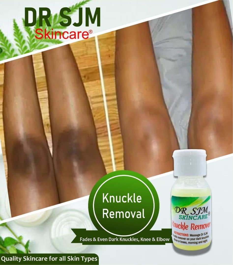 Dark knuckles remover