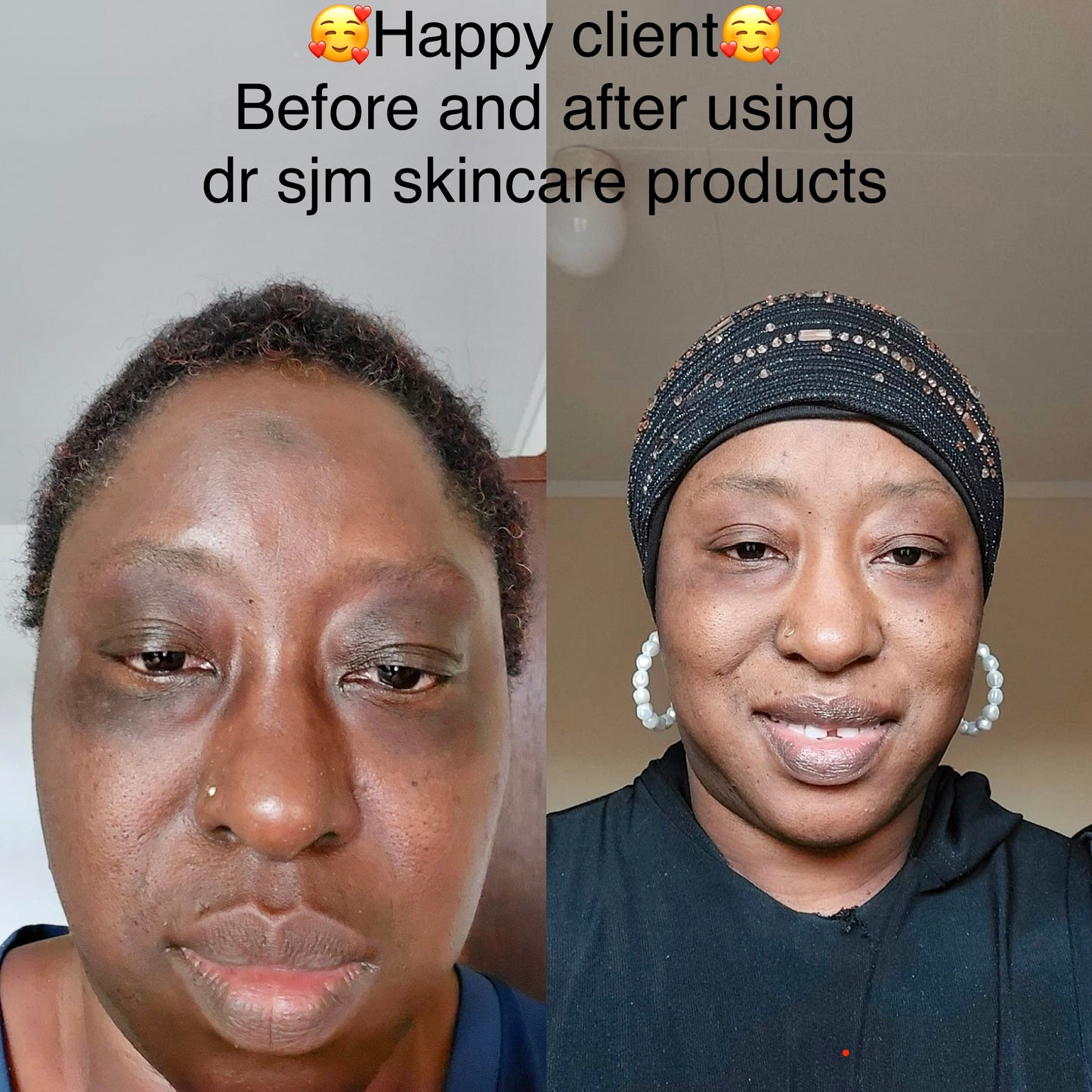 Hypoallergenic set