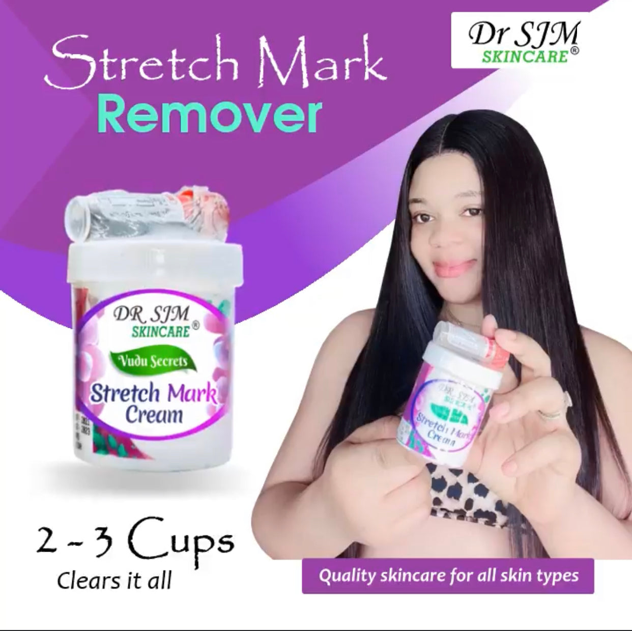 Stretch marks remover